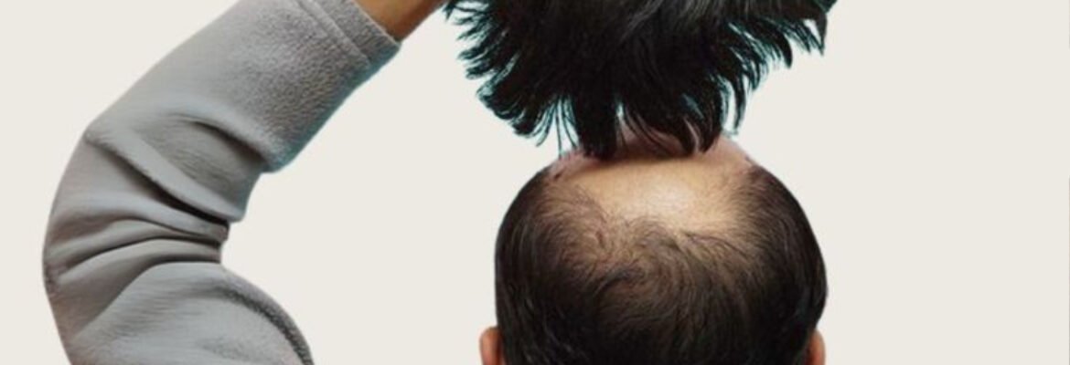 Hair Wigs in Islamabad